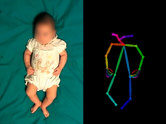 infant and pose estimation overlay side by side
